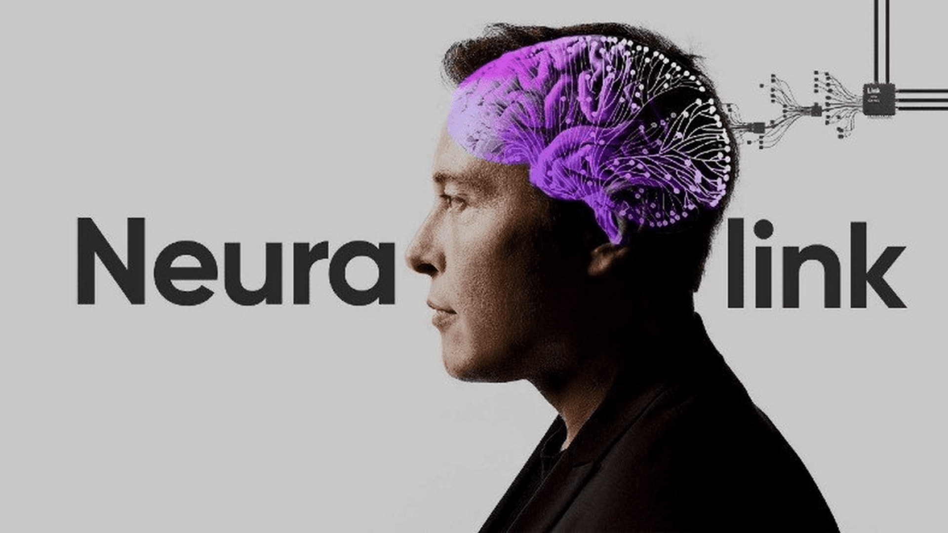Primeiro Implante Cerebral Promete Revolucionar a Interação Mente-Máquina!